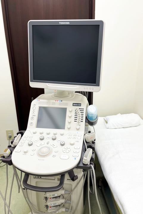 超音波診断装置